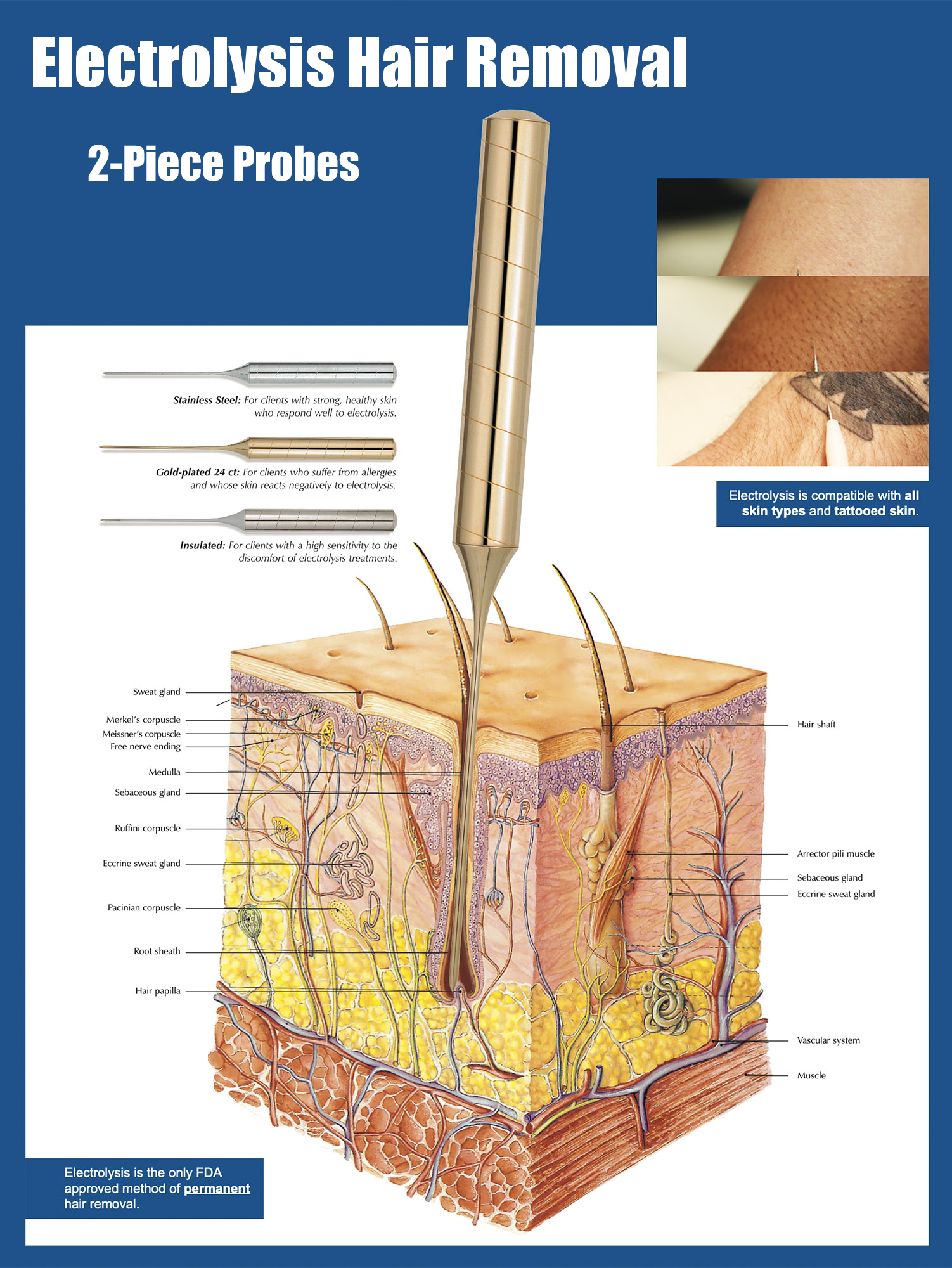electrolysis diagram showing needle entering follicle
